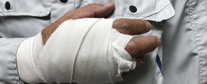 Seriously injured worker has serious hand injury