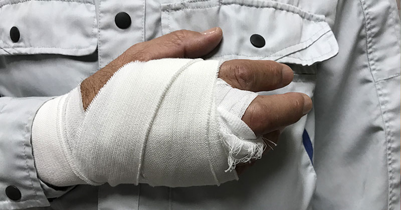 Seriously injured worker has serious hand injury